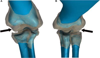 Constraining Morphologies of Soft Tissues in Extinct Vertebrates Using Multibody Dynamic Simulations: A Case Study on Articular Cartilage of the Sauropod Dreadnoughtus